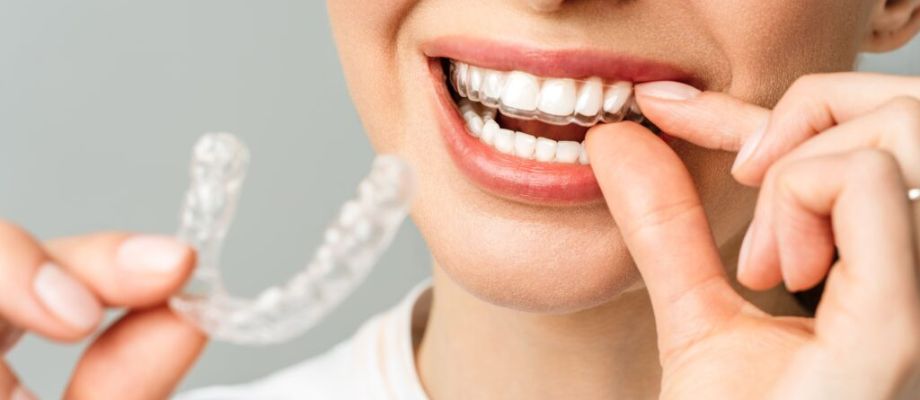 invisible-braces-treatment