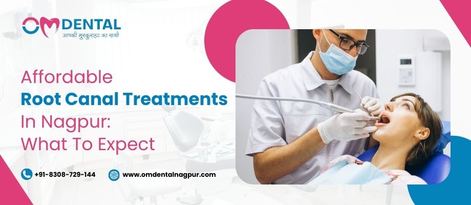 Affordable Root Canal Treatments in Nagpur: What to Expect