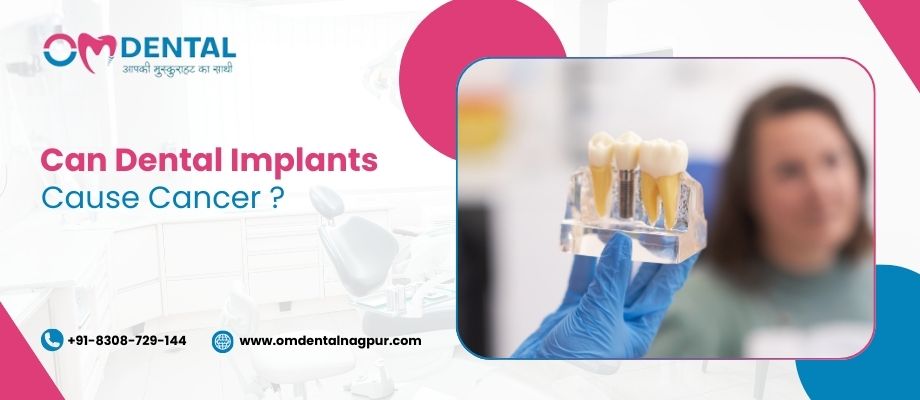 Can Dental Implants Cause Cancer