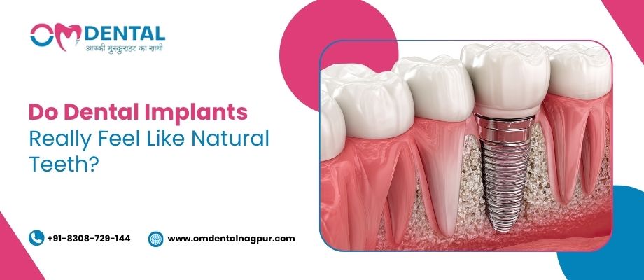 dental implant in trimurti nagar