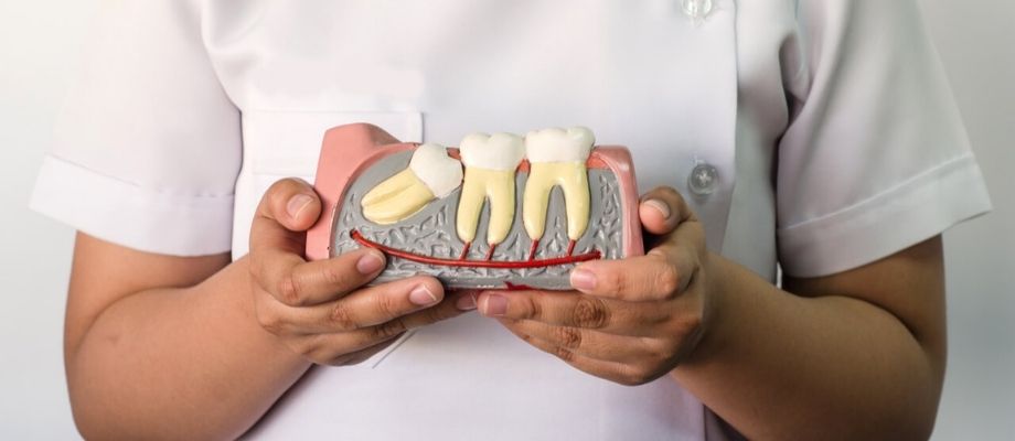 Do’s and Don’t for Third molar/ Wisdom tooth Extraction