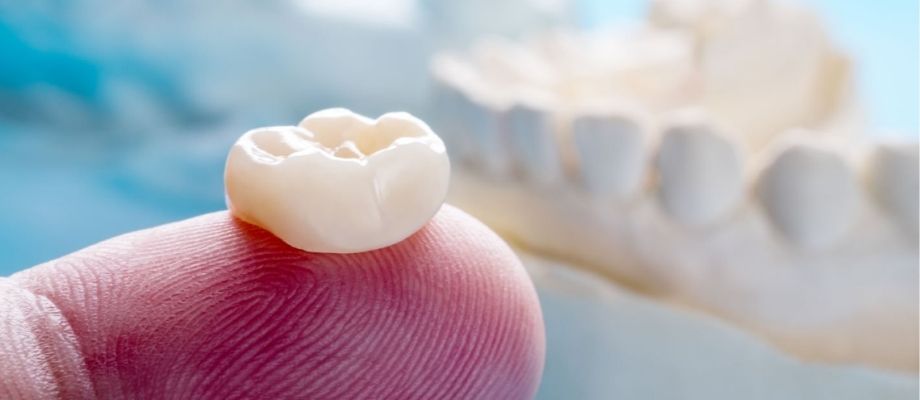 Is there a need of crown (cap) over RC treated teeth??