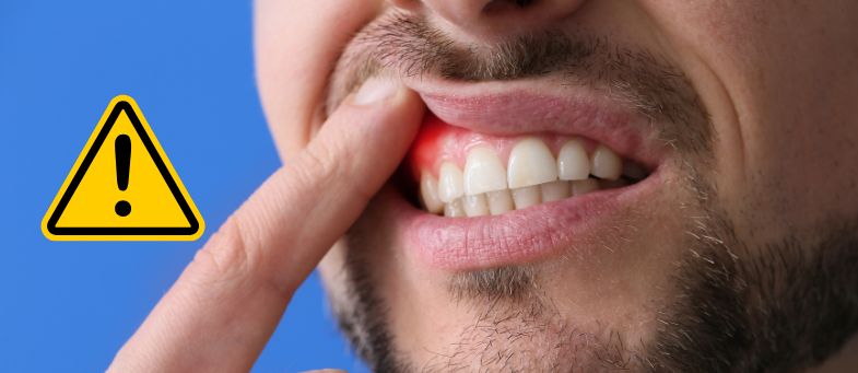 Warning Signs of Gum Disease and How To Treat It