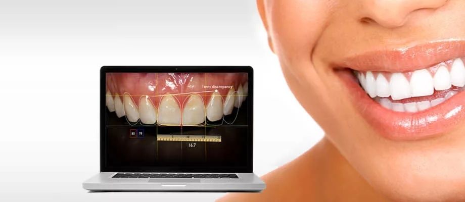 What Is Smile Designing?